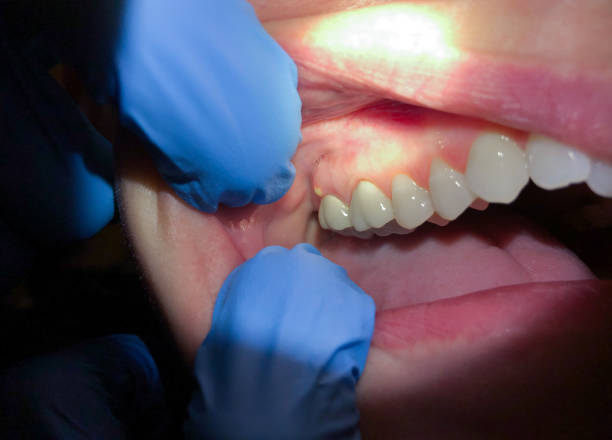 Best After-Hours Dental Trauma Care in Matheny, CA