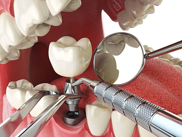 Best Weekend Emergency Dentist in Matheny, CA
